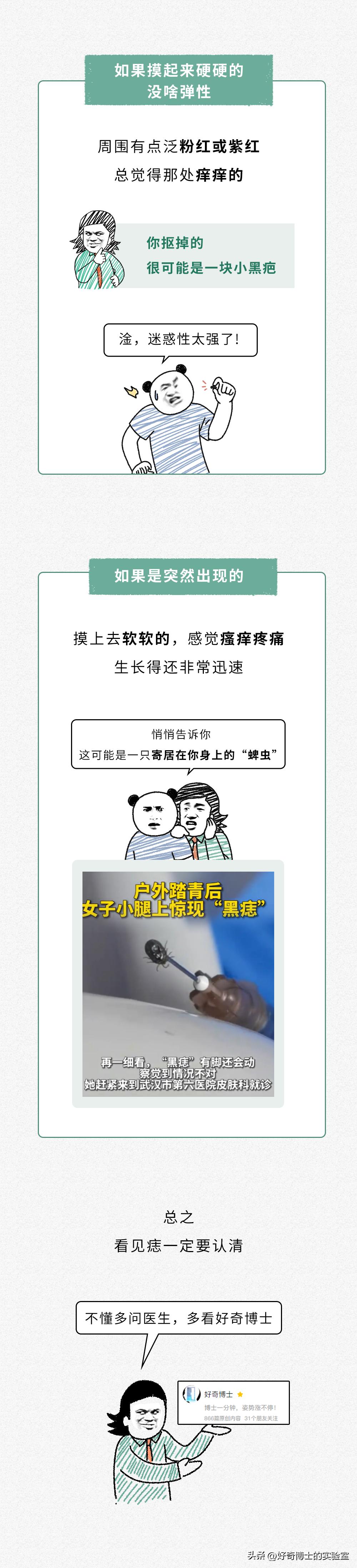 身上的痣被抠掉了会发生什么事情,身体上的痣可以抠掉吗