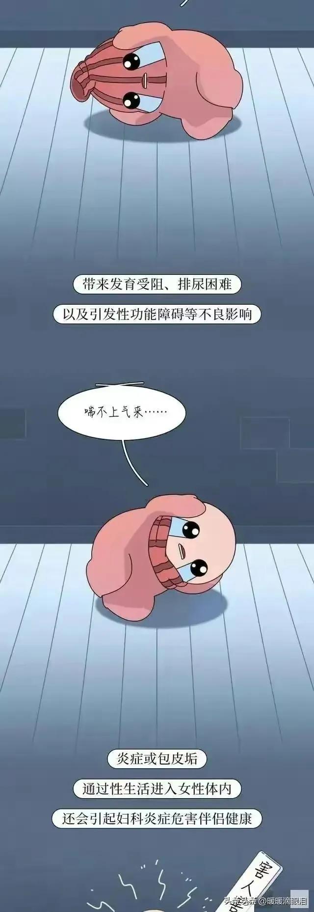 割完包皮会有什么变化,男生割过包皮之后有什么变化