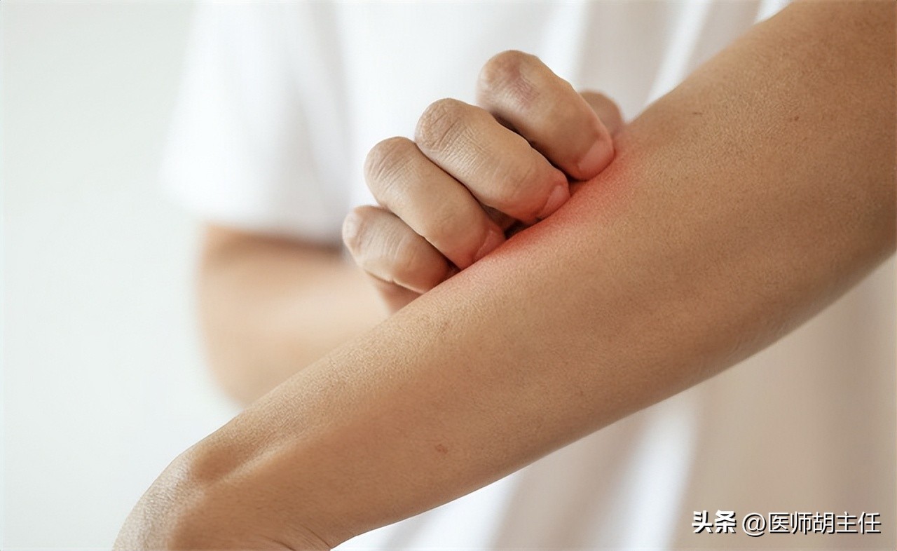 别把艾滋病当皮肤病治,不要错把艾滋病当皮肤病