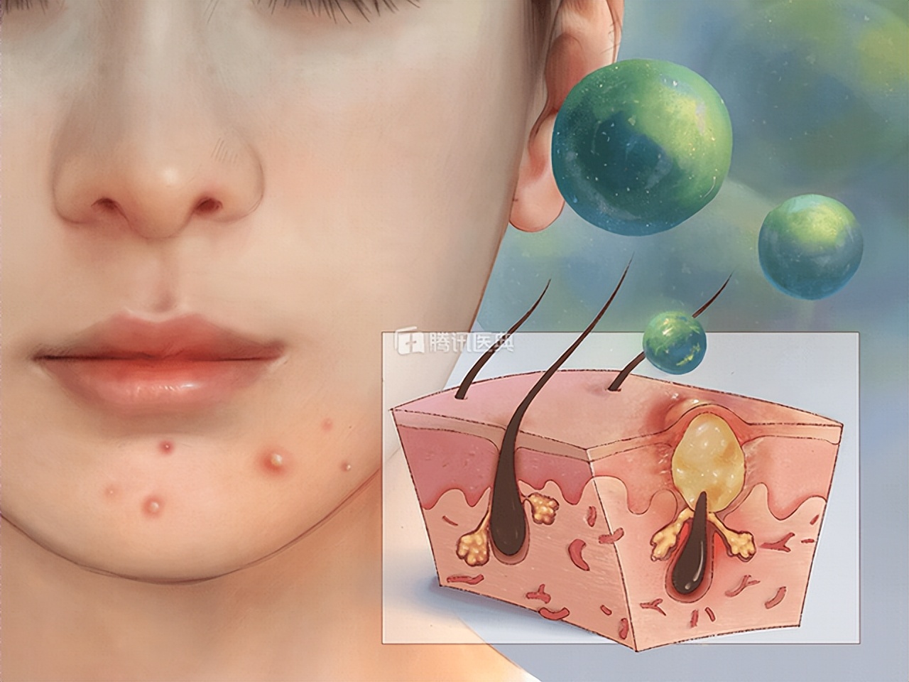 果酸换肤能彻底解决皮肤问题吗,角质薄可以做果酸换肤吗