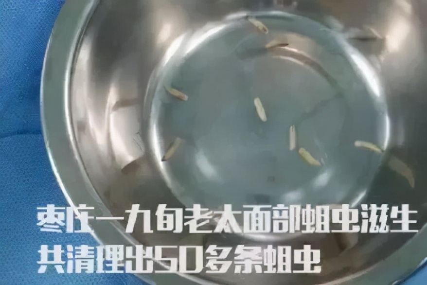 卫生间小飞虫的危害程度超乎你的想象,它究竟是啥?该如何消灭?