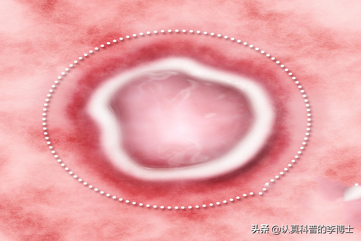 口腔溃疡用维c真的有用吗,口腔溃疡反复发作补什么维生素