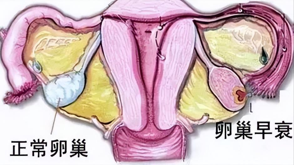 大妈上厕所正用力，身体掉下一块“肉”？医生坦言：这是你的子宫