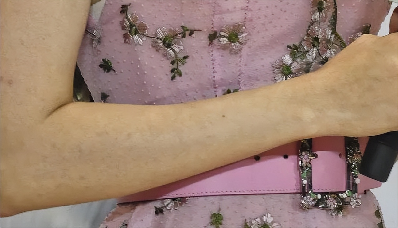 假发假臀假肌肉，半个娱乐圈“从头假到脚”，原来没什么是真的