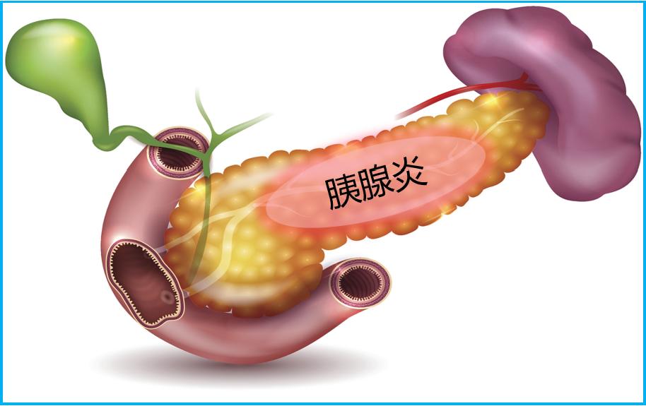 医学科普胰腺炎饮食,胰腺炎科普知识