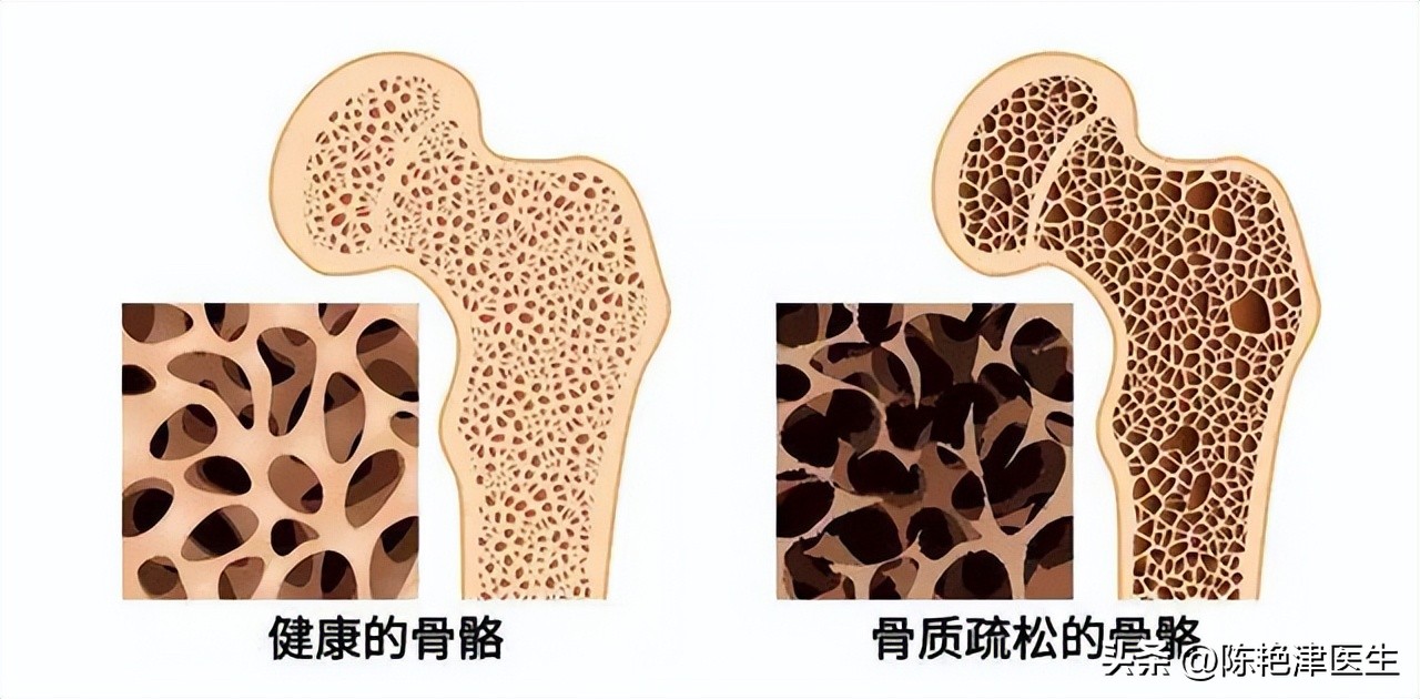 老年人腿没有力吃什么补,老年人腿无力需要补充什么营养