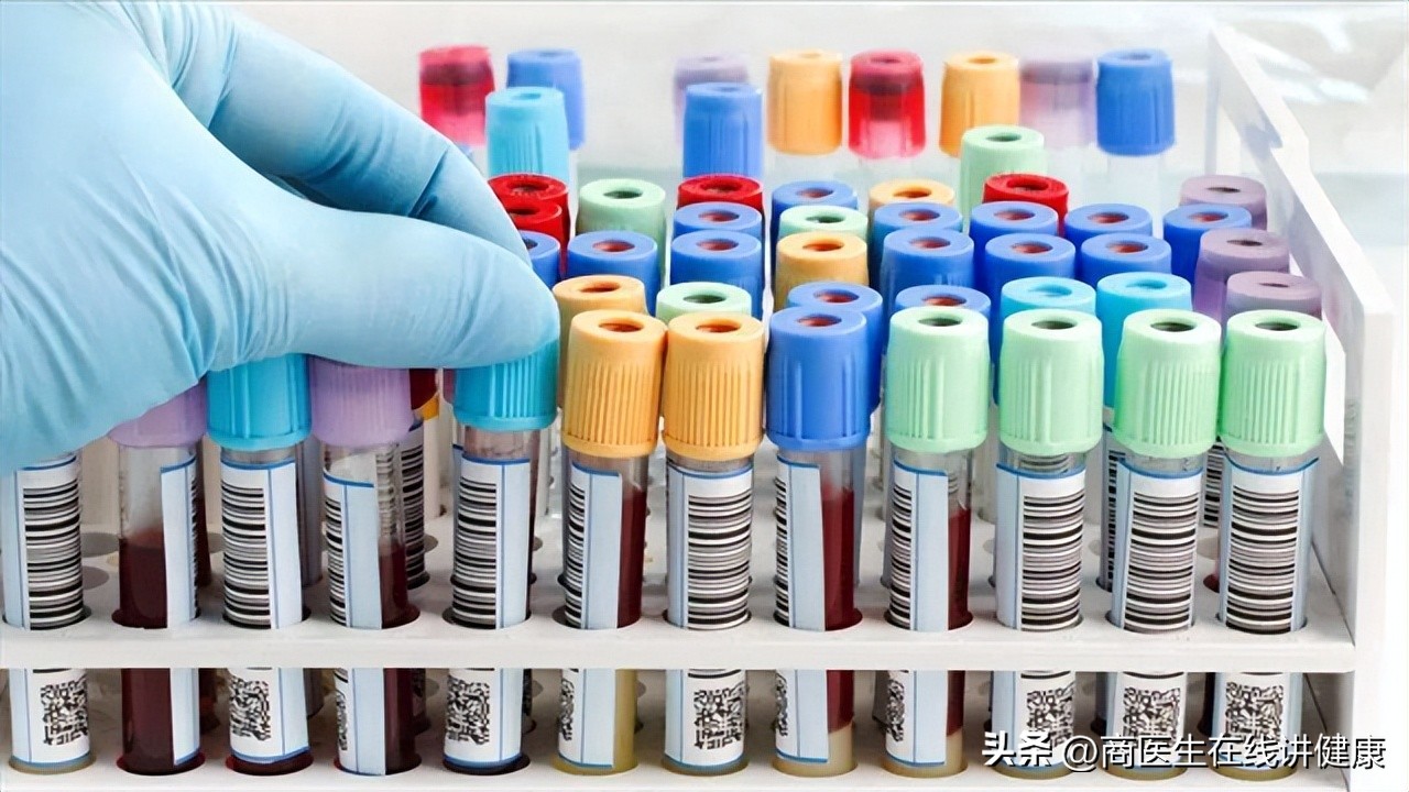 二型糖尿病可以不吃药控制血糖么,二型糖尿病不吃药控制血糖能降吗