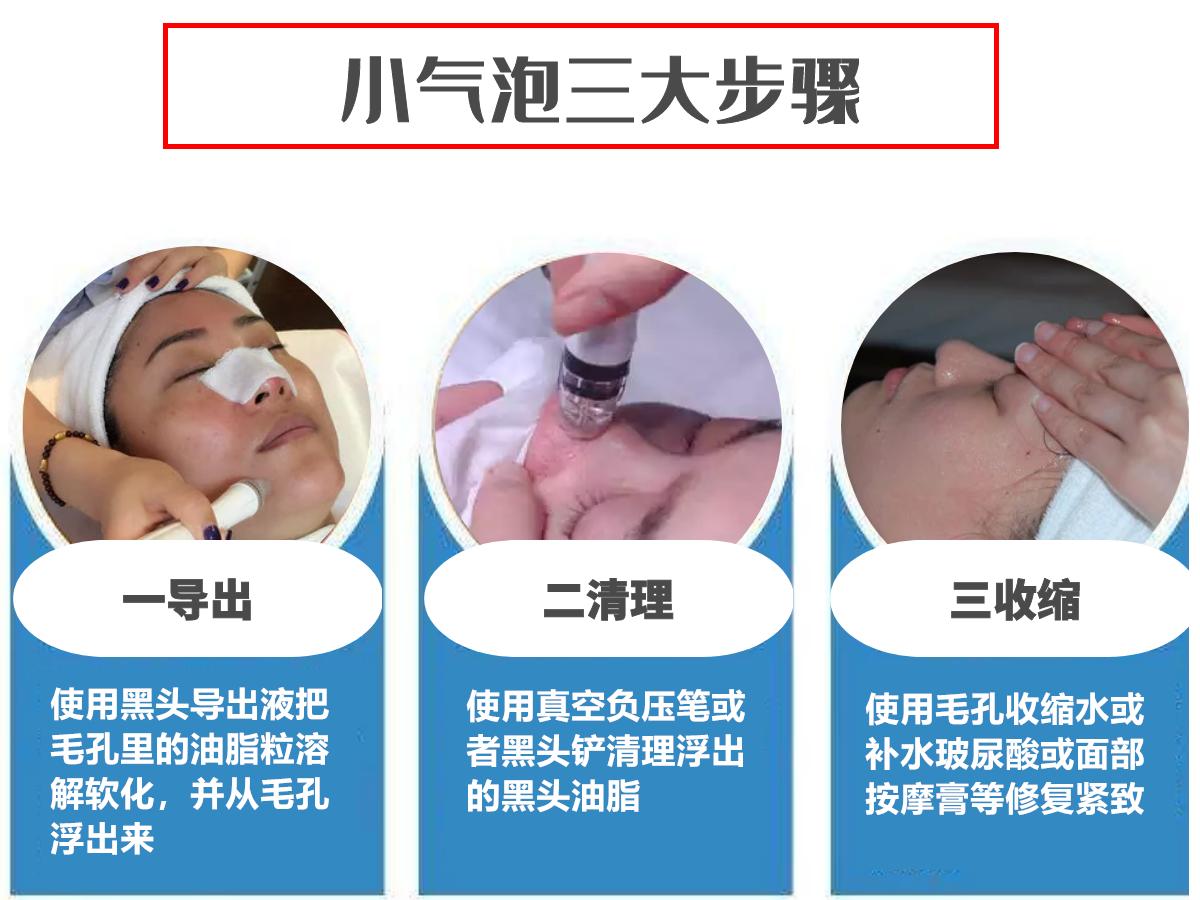 美容院护肤去黑头正常价格,小气泡去黑头美容仪器