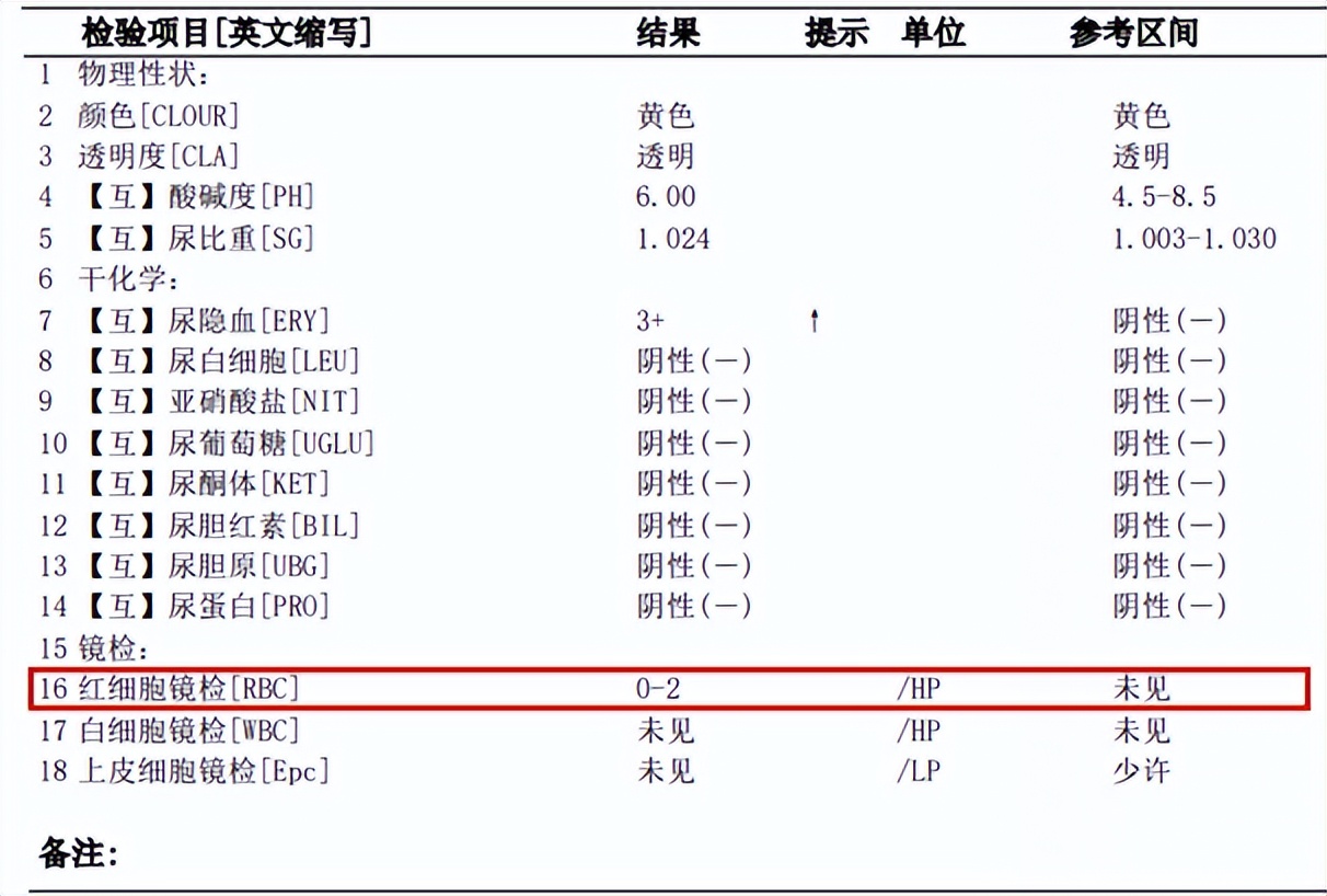 月经期间体检会出现尿隐血阳性吗,体检尿隐血阳性3+挂什么科复查