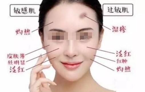 如何祛除脸上痘坑痘印,脸上的痘印怎么祛除