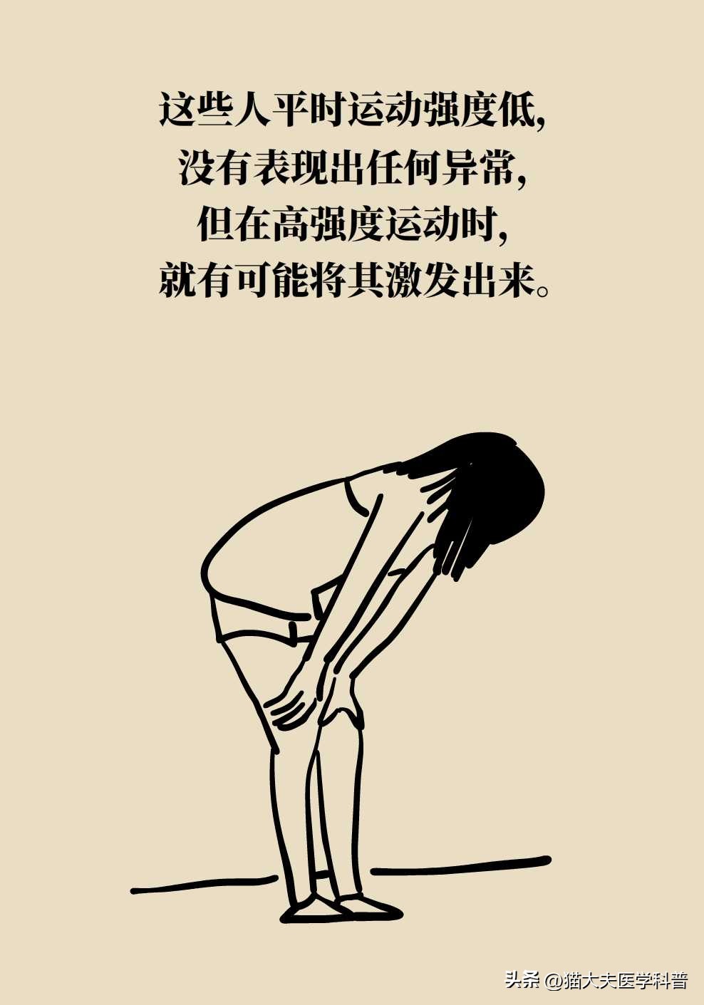 运动性猝死的六种表现,运动性猝死解释