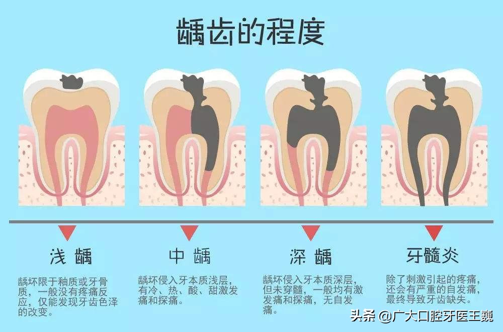 牙有一点点黑线怎么刷掉,所有大牙上都有黑线刷不掉