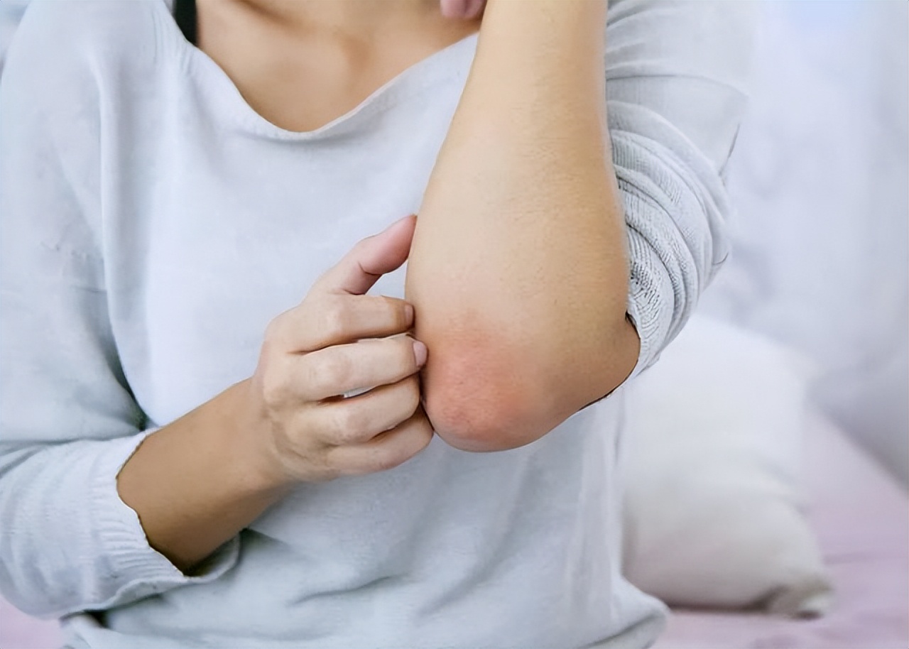 身体有2处发痒别误以为是过敏,身体过敏发痒但是表面没有疹