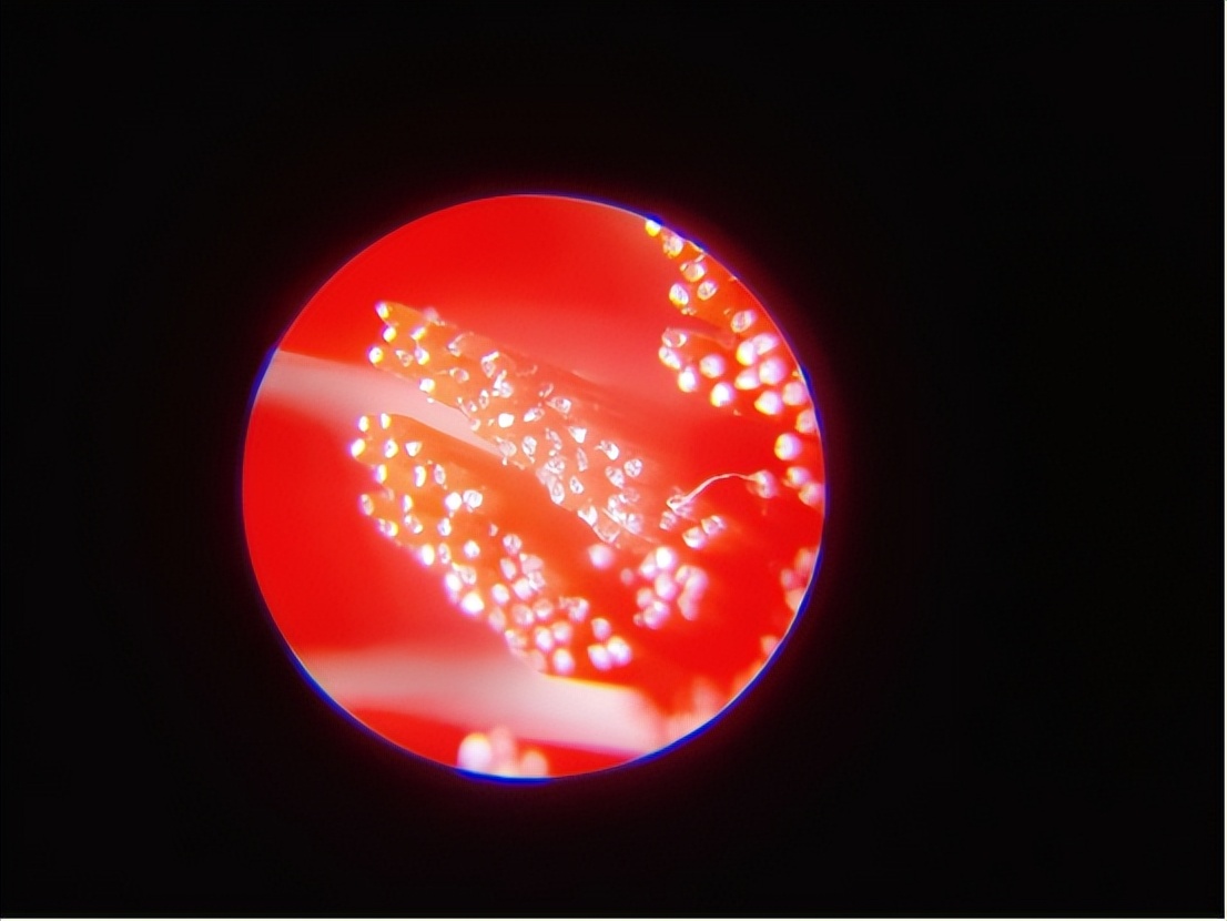 飞利浦usmile电动牙刷哪个更好,欧乐b和飞利浦扉乐电动牙刷评测