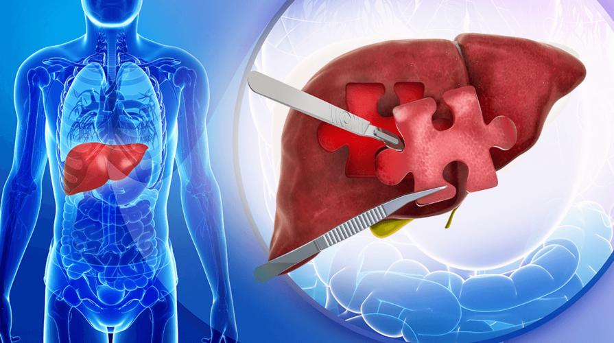 肝癌小细胞癌的治疗方法,肝癌的诊断和治疗方法简答题