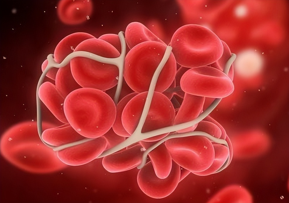 低压高为什么更可怕,低压偏高是什么原理