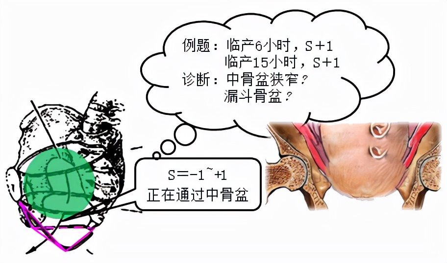 孕妈妈怎么判断胎位是正的,胎儿屁股在右侧是什么胎位