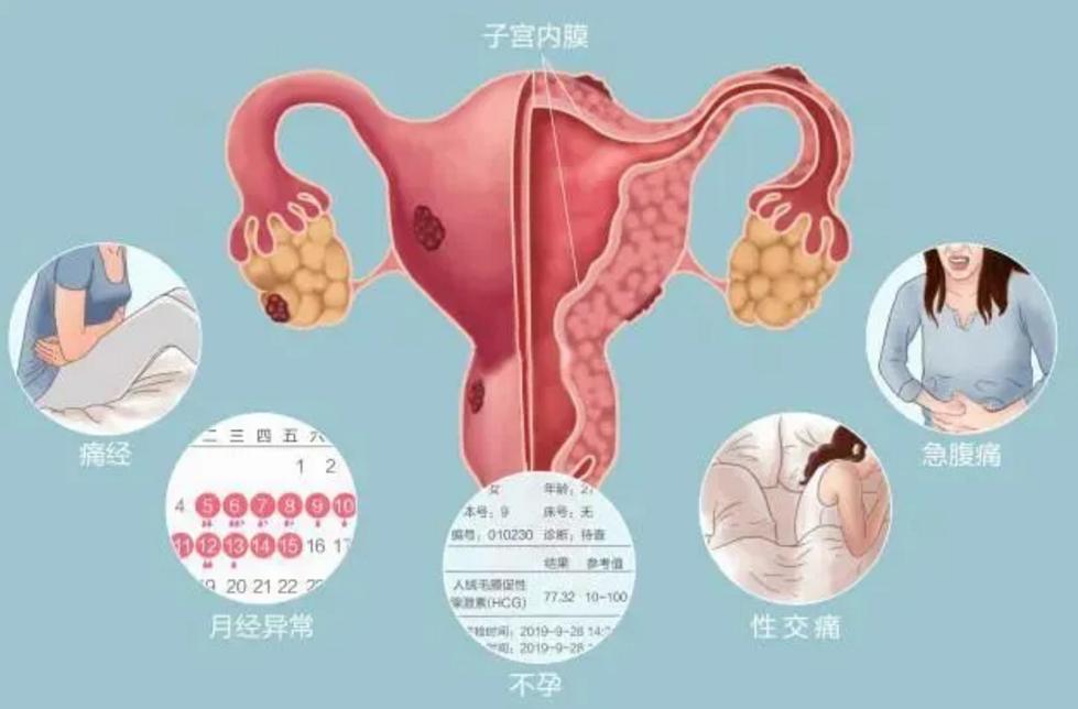 子宫切除了夫妻有什么影响,子宫切除对夫妻有什么影响