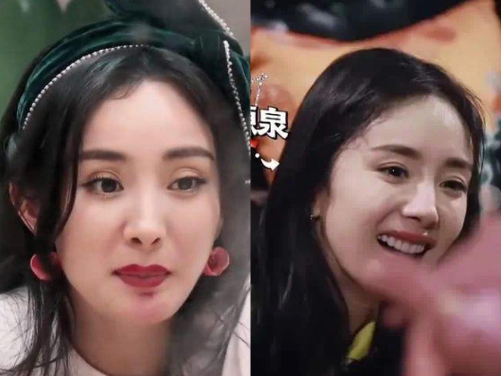 哪些明星整容后遗症越来越严重,整容明星后遗症对比图片