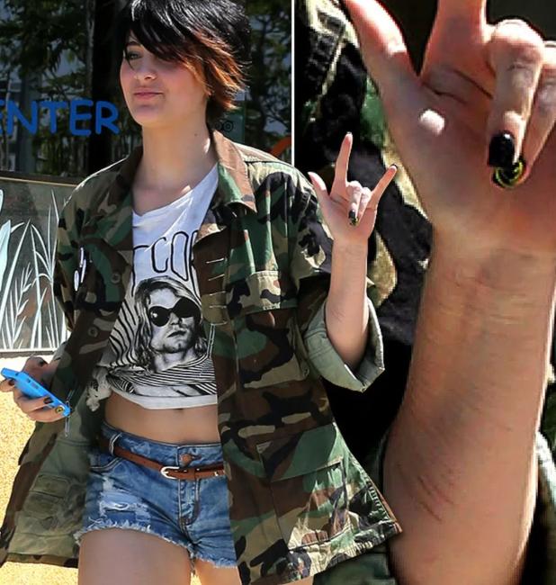 杰克逊大儿子遗传病,迈克尔杰克逊去世得了什么疾病