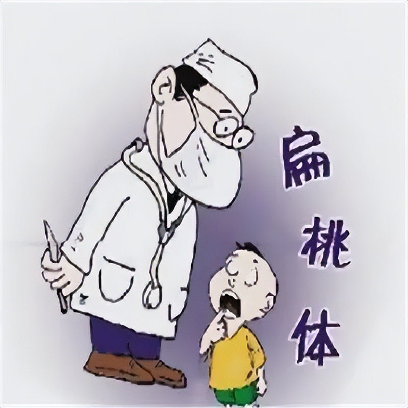 扁桃体发炎怎么快速治好,慢性扁桃体发炎需要切除扁桃体吗