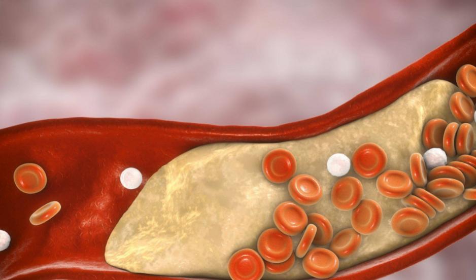 吃核桃对心血管病有好处吗,核桃对心血管病的功效