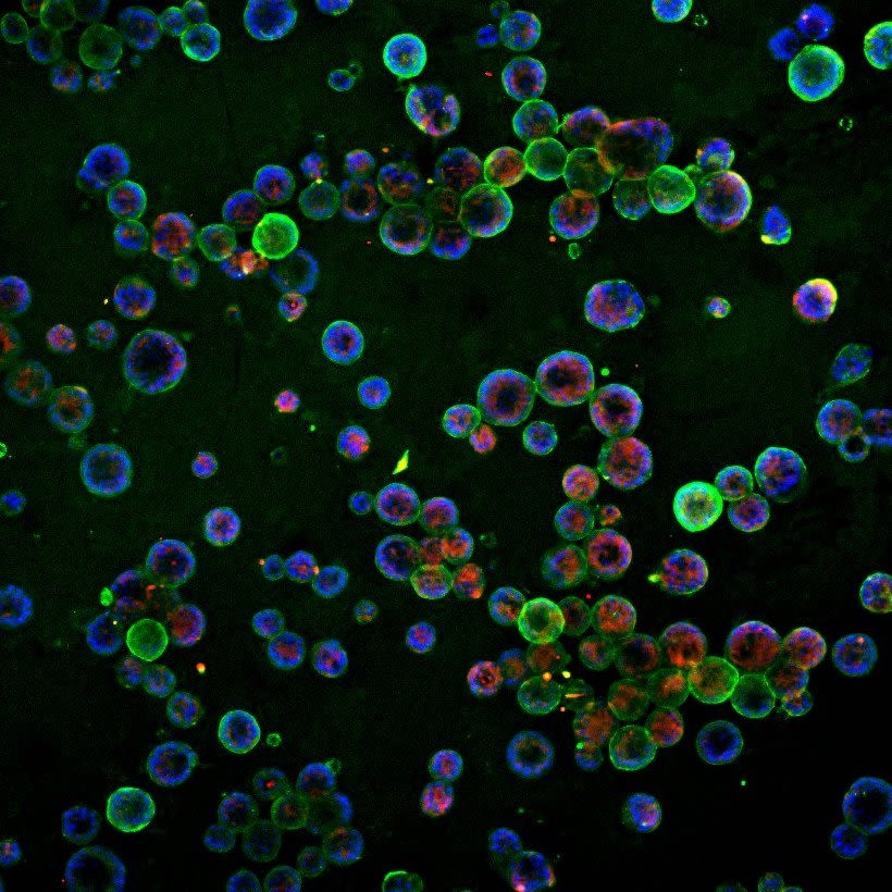 网上买熊去氧胆酸便宜吗,哪个牌子的熊去氧胆酸好