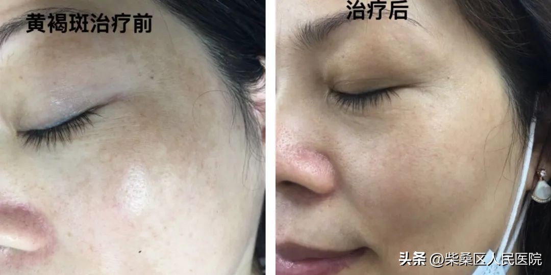 【医疗惠民】柴桑区人民医院3.8女神节优惠活动又来啦！