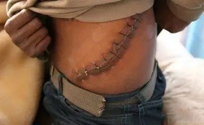 东南亚远比你想象中更可怕：电击、水牢、吃屎，挖器官不打麻药