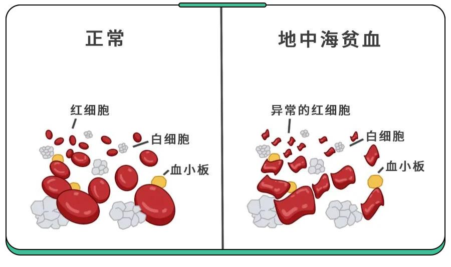 70岁老人为救孙女每天扛20吨草料,20岁才发现地贫还能治吗