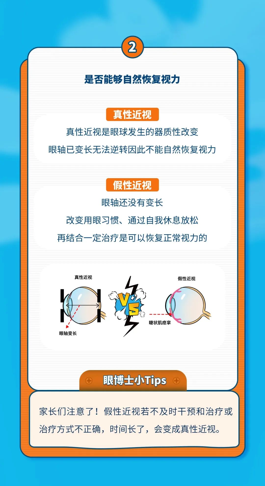 眼睛看不清要立刻去配眼镜吗,孩子眼睛看不清了需要配眼镜吗