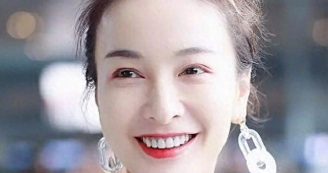 明星烤瓷牙发黑,明星烤瓷牙牙齿磨小后照片