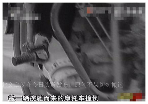 真实故事女子患怪病,真实事件女孩长胡子