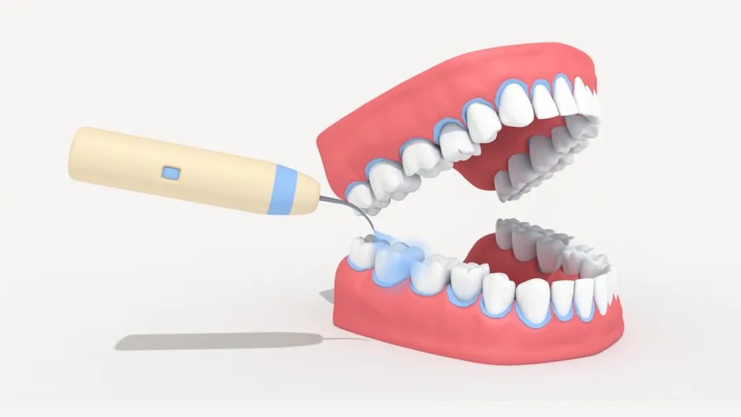 每天刷牙牙齿还是发黄是怎么回事,牙齿刷牙每天都出血怎么解决