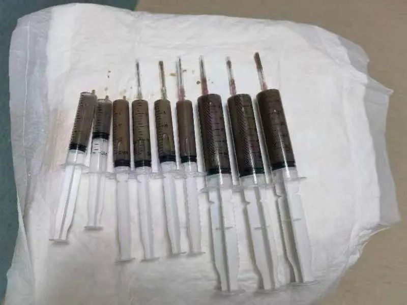 误吞异物成功案例,误吞硬物怎么救