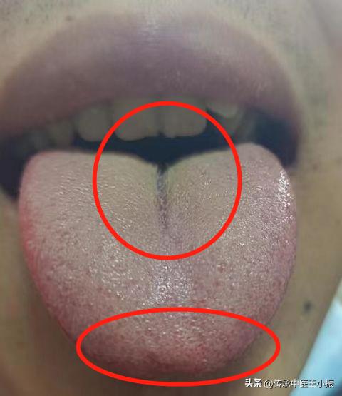 知柏地黄丸吃了真的有用吗,知柏地黄丸可以吃多久才有效