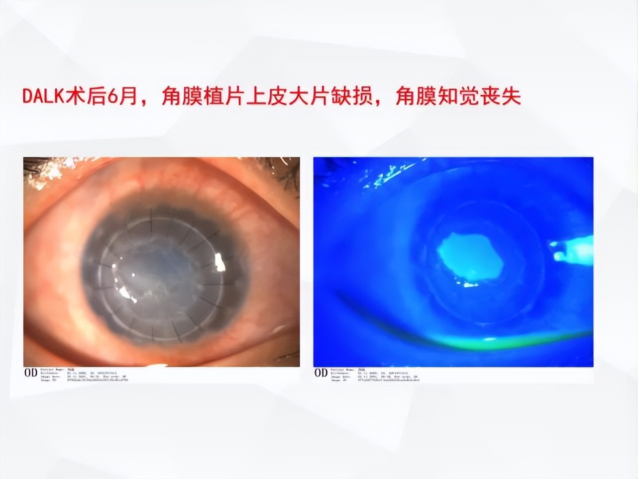 邓志宏几号坐诊,湘雅附三眼科邓志宏简历