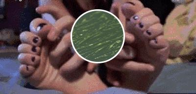 一走路脚趾甲里疼怎么回事,甲沟炎拔完脚趾甲很疼怎么办