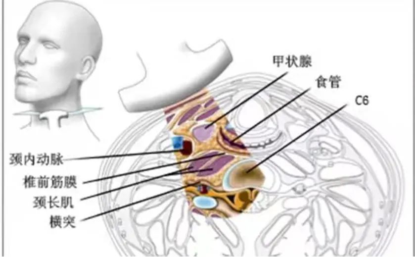 濮阳市人民医院：“看得见”的治疗-超声引导下星状神经节阻滞术