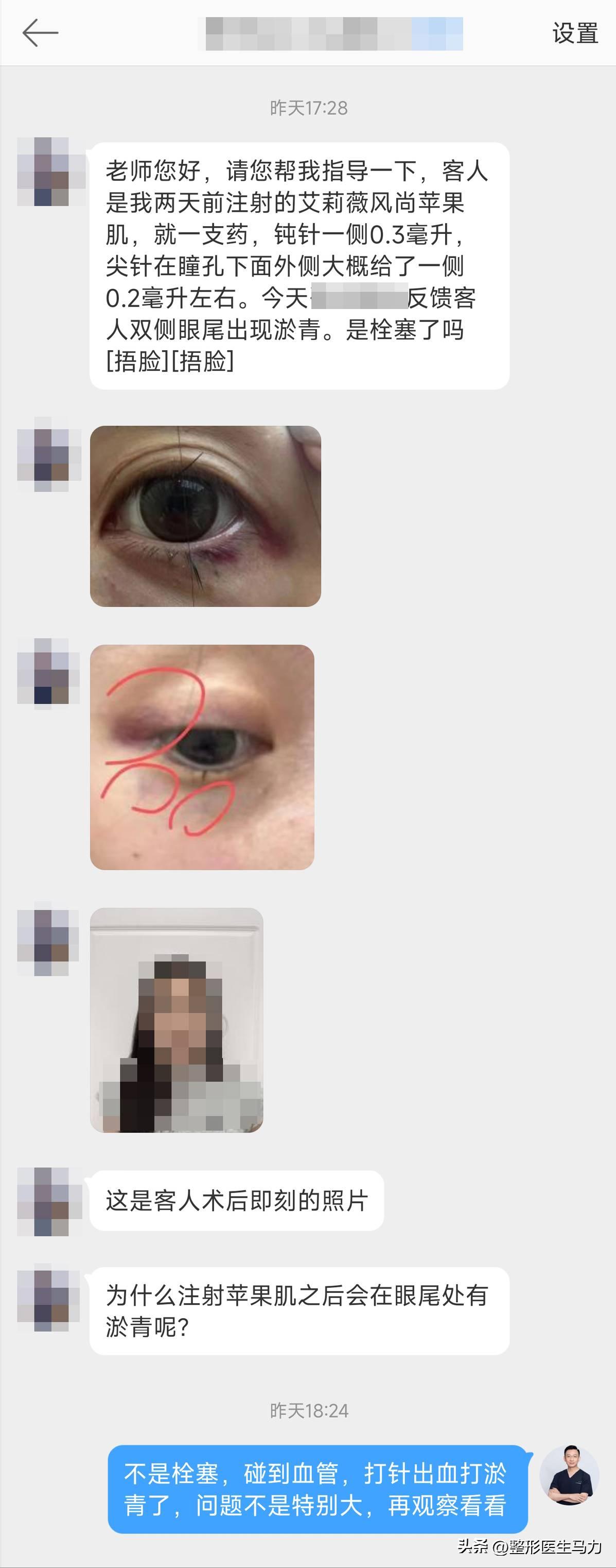 三甲医院注射玻尿酸都没事吧,三甲医院的医生注射玻尿酸专业吗