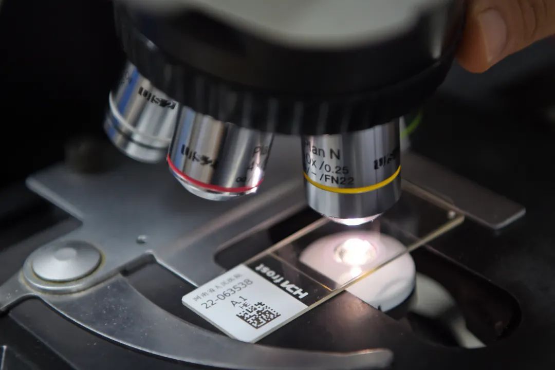 医生说病理报告有点小问题,病理报告没出来好害怕啊