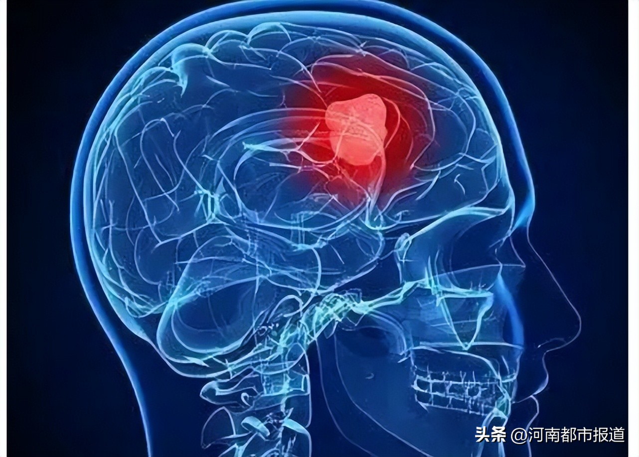 头晕头昏脑胀大脑不清是什么原因,突然头晕是大脑哪些信号