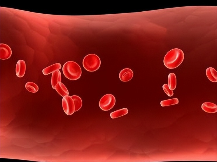 痛风可以放血治疗吗？痛风治疗三部曲，治疗效果翻倍