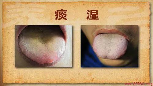 眩晕，头痛头昏，健忘，痰蒙清窍，六味药，燥湿化痰，平肝熄风。