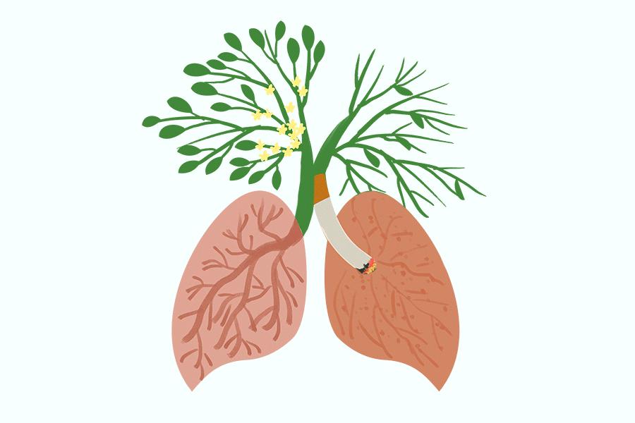 放疗后肺纤维化怎么办,放疗后肺间质纤维化吃什么药治疗