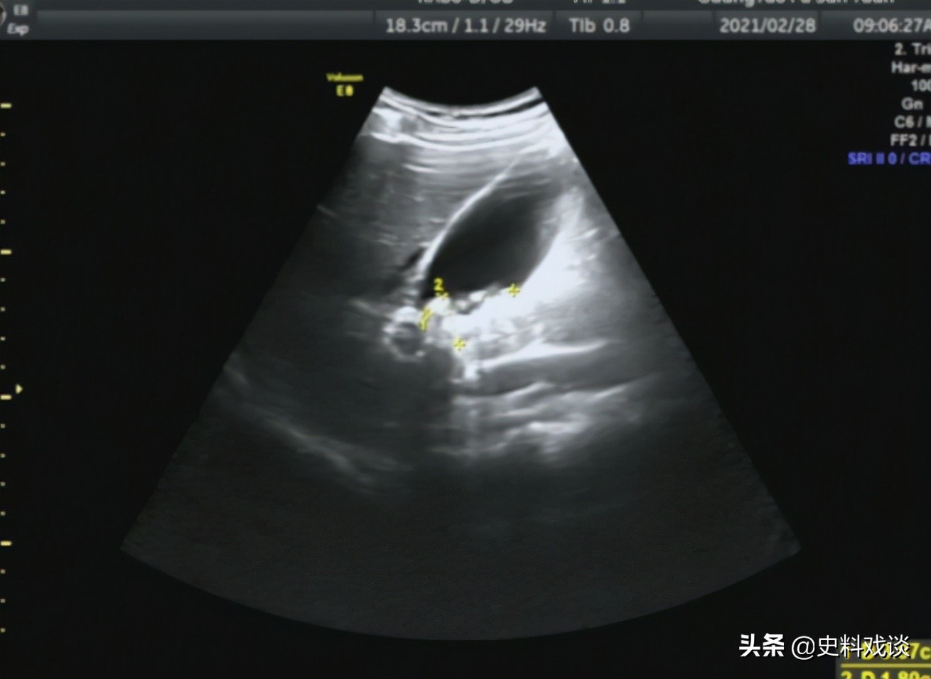 湖南一男子年后返乡和妻子告别,男子外出打工一年偷偷回一次家