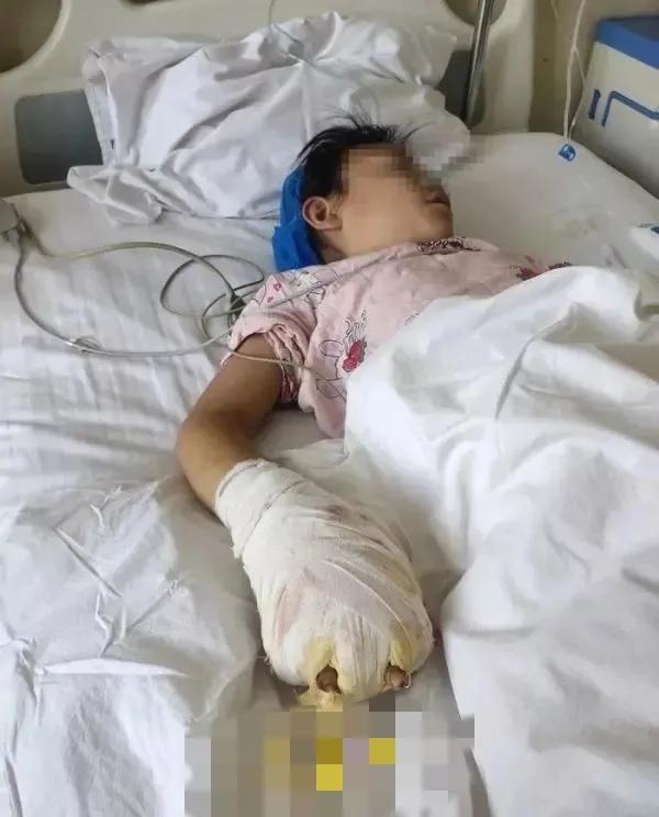 后妈把小孩按在地上暴打,后妈狠心用烟头弄孩子手上痛哭