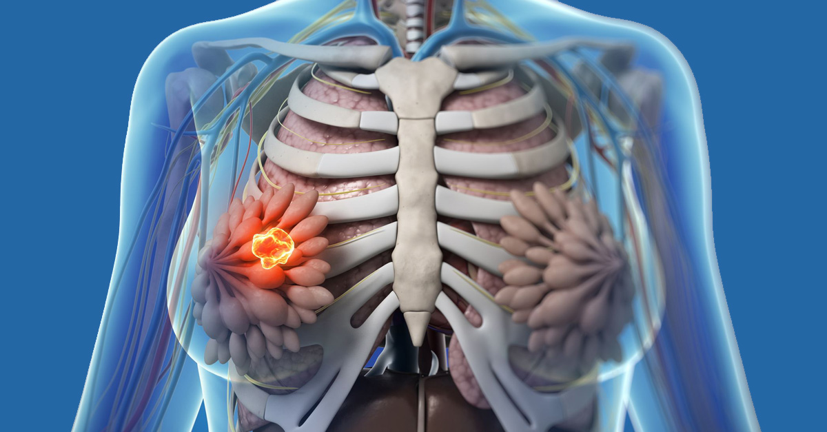 原来乳腺增生是一件严重的事,乳腺增生的10个严重症状