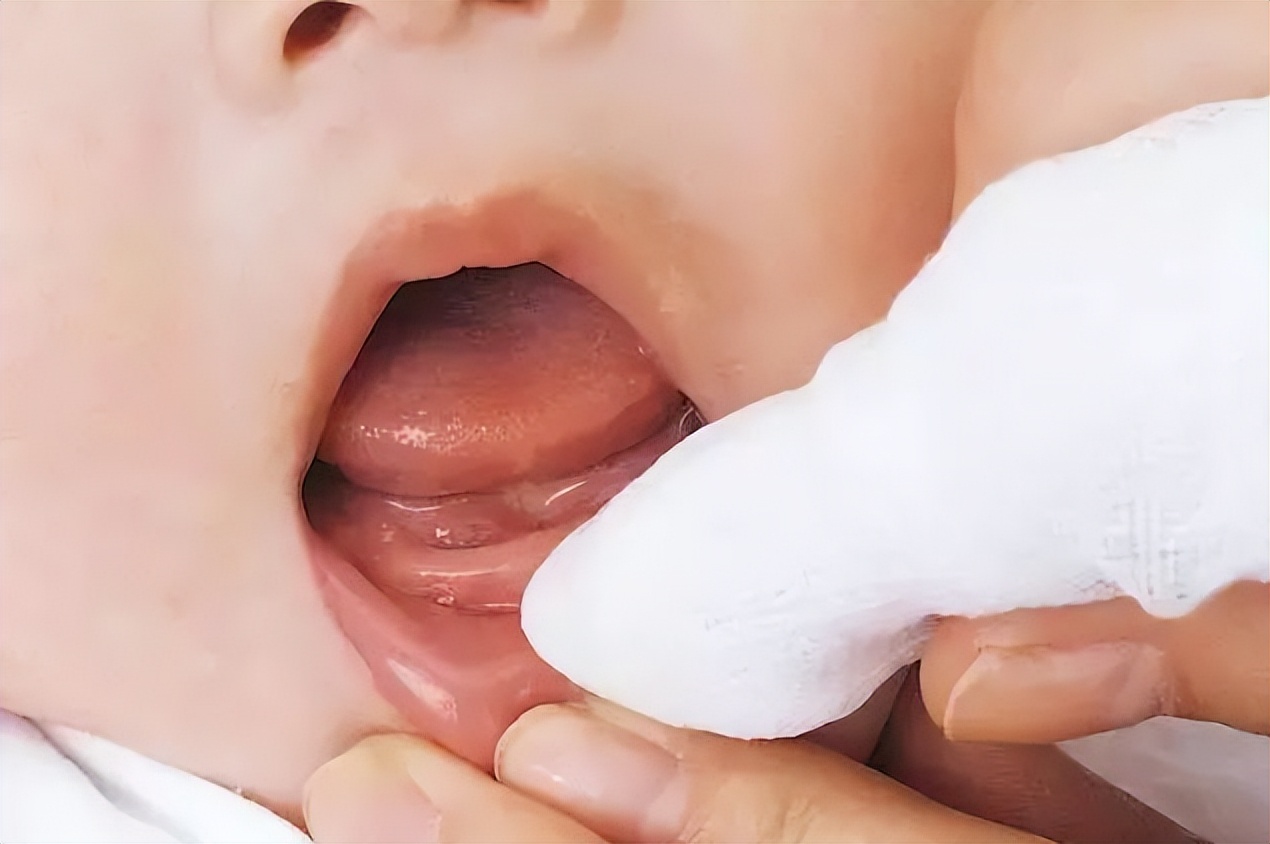 照顾宝宝时，别忽视口腔护理！需做好4件事，将来才不容易长黑牙