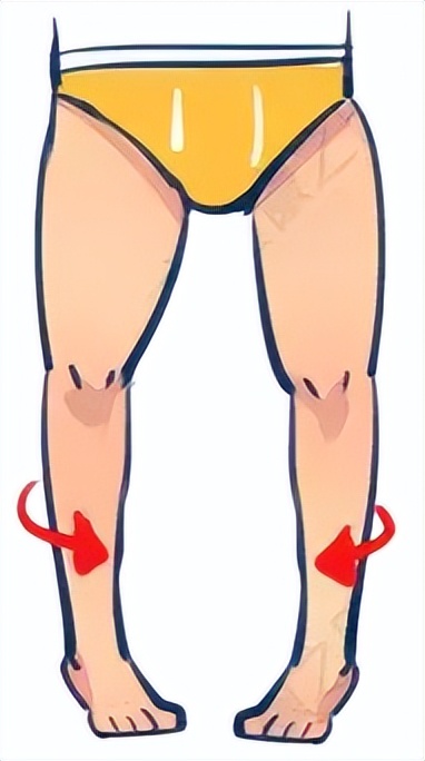 小腿变弯曲是缺钙了吗,小腿变弯处理方法